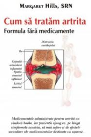 Cum sa tratam artrita - Margaret Hills, Srn