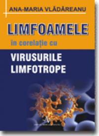 Limfoamele in corelatie cu VIrusurile limfotrope - Ana-maria Vladareanu