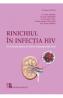 Rinichiul in infectia HIV. De la boala cronica de rinichi la transplantul renal - Dr. Oana Ailioaie - Oana Ailioaie